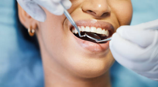 Best After-Hours Emergency Dentist in Springfield, OH
